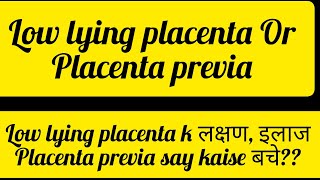 Placenta previa के लक्षण और उपचार Low lying placenta से कैसे बचें [upl. by Drahser]