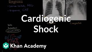 Cardiogenic shock  Circulatory System and Disease  NCLEXRN  Khan Academy [upl. by Rieth]