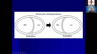 Constrictive vs restrictive Cardiomyopathy by Dr SK PAra [upl. by Naesyar]