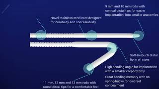 Rigi10™ Features and Benefits at a Glance [upl. by Ahtram]