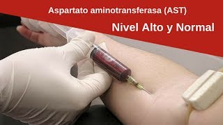 Análisis de aspartato aminotransferasa AST alto y bajo [upl. by Eiralc]