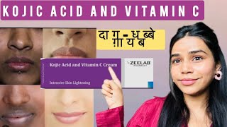 kojic acid and vitamin c cream  kojic acid vitamin c cream  kojic acid and vitamin c cream review [upl. by Jemina658]