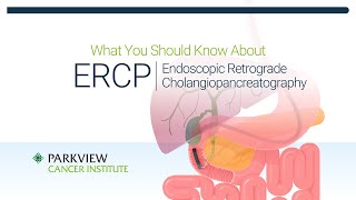 What You Should Know About ERCP Endoscopic Retrograde CholangioPancreatography [upl. by Kussell]