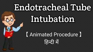 Endotracheal Tube Intubation  Animated Procedure  Hindi [upl. by Makell]