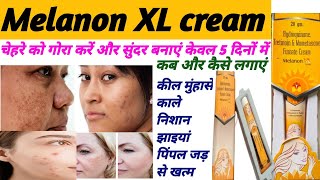 Melanon XL Cream  कील मुंहासे और काले निशान को जड़ से खत्म करें और चेहरे गोरा बनाएं  melanon XL [upl. by Sylvester]