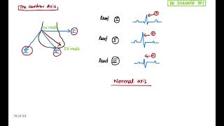 ECG  Normal Axis Right amp Left Axis Deviation  ECG Simplified Episode 3  Dr Shankar Dey [upl. by Stryker773]