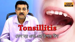 Tonsillitis কি এবং কেন হয় কিভাবে এর থেকে রেহাই পাবেন কি বলছেন ENT Surgeon  EP 323 [upl. by Otiragram729]