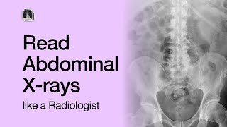 How to Read an Abdominal XRay [upl. by Hnil]