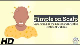 Scalp Pimples Unveiled Causes and How to Deal with Them [upl. by Ehtiaf874]