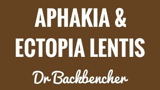 Aphakia and Ectopia Lentis  Etiology symptoms and management  Ophthalmology Lectures [upl. by Eelyac]