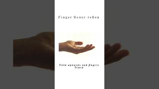 Finger flexor reflex reflex kattrucate anatomy medicalreels education signs finger flexor [upl. by Carlen]