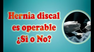 Hernia disca es operable ¿Si o No [upl. by Tita]