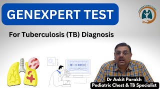 GeneXpert or CB NAAT test for Diagnosis of Tuberculosis I Dr Ankit Parakh Child TB Specialist [upl. by Eward637]