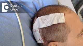 What are the risks in a Craniotomy  Dr Bopanna K M [upl. by Airtal]