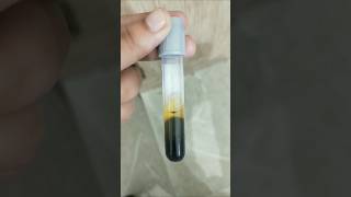 Sodium fluoride tube  Blood Sugar test  Glucose test  Sugar test glucosetest bloodsugar dmlt [upl. by Felipe]