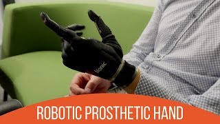 Review of The Bebionic Hand by Triple Amputee [upl. by Ardnuhsed970]