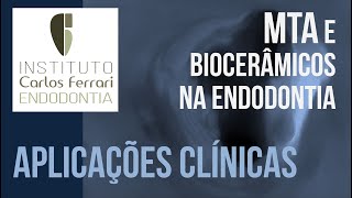 MTA e Biocerâmicos na Endodontia  2a parte Aplicações clínicas [upl. by Sebbie630]