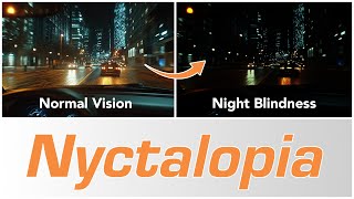 Night Blindness Nyctalopia  Causes amp Treatments [upl. by Wake]