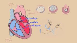 LES Valvuloplasties cardiaques [upl. by Newbill54]