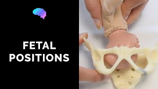 Types of Fetal Positions  OSCE Guide  UKMLA  CPSA [upl. by Winikka]