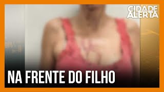 Médica é espancada pelo marido na frente do filho em Uberlândia  Cidade Alerta Minas [upl. by Hillari]