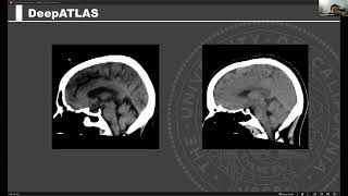 Peter Chang  TensorFlow for Medical Federated Learning [upl. by Engracia]