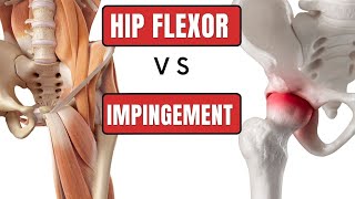 Get the Right Diagnosis FAI Impingement or Hip Flexor Strain [upl. by Eradis]