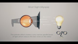 Pinhole Glasses Animation [upl. by Placia]