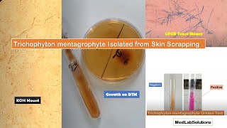 Trichophyton mentagrophyte isolated from clinical sample Skin Scrapping [upl. by Annayak]