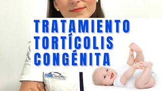 TRATAMIENTO TORTÍCOLIS CONGÉNITA [upl. by Herates368]