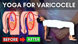 Varicocele Exercises Part 1 Follow Along At Home  Yoga for Varicocele varicocele [upl. by Brion202]