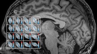 Introduction to DiffusionWeighted MRI and Microstructure Imaging [upl. by Lemrej]