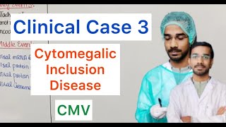 Clinical Case 3  Cytomegalic Inclusion Disease  CMV [upl. by Aurilia]