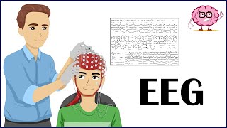 EEG Electroencephalogram  How It Is Done Indications Types Of EEG  Patient Education [upl. by Boylan]