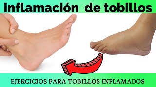 inflamación crónica de tobillo como quitarla [upl. by Hanauq]