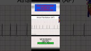 Atrial Fibrillation Causes Symptoms and Treatments  Explained by a Medical Professional [upl. by Lussier]