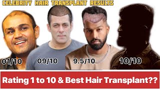 CELEBRITIES WHO HAD THEIR HAIR TRANSPLANT  Hair Transplant Results [upl. by Wincer45]