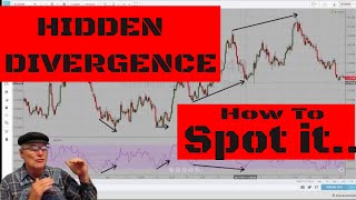 Hidden Divergence How to spot it and what it means [upl. by Churchill742]