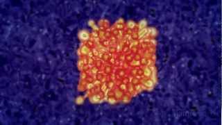 Immunotherapy Boosting the immune system to fight cancer [upl. by Cimbura]