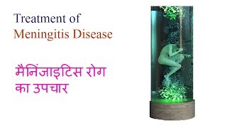 मैनिंजाइटिस रोग का इलाज  Treatment of Meningitis Disease Video 9 by Ayurveda amp Health [upl. by Massiw]