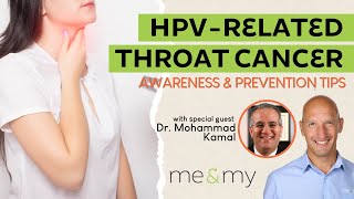 HPV Oropharyngeal Cancer Awareness and Prevention with Dr Mohammad Kamal [upl. by Virgilio384]