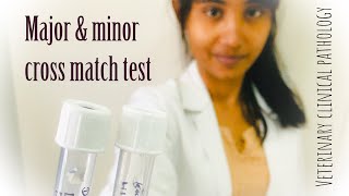 Cross match test major and minor [upl. by Atineb]