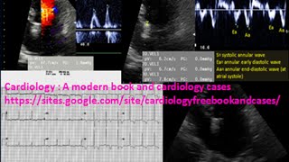 A patient with hypertension The ECG echocardiogram and left ventricular diastolic function [upl. by Inobe]