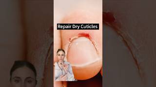 Revive Your Nails Fixing Damaged Cuticles [upl. by Aretse939]