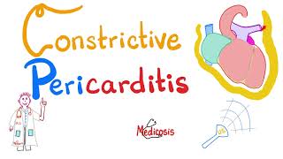 Constrictive Pericarditis  Causes Symptoms Signs Diagnosis amp Management  Cardiology [upl. by Ronaele]