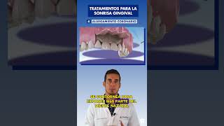 El ALARGAMIENTO de CORONA dental  Una SOLUCIÓN para la sonrisa GINGIVAL [upl. by Riem]