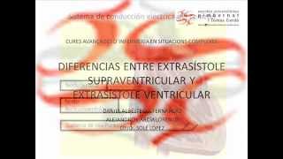 Extrasístole diferencias entre supraventricular y ventricular [upl. by Bellanca640]