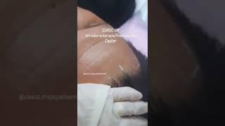 Curso Vip de Intradermoterapia Pressurizada  Tratamento Capilar estetica esteticista beleza [upl. by Fiorenza]