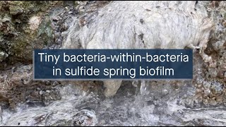 Evidence of tiny bacteriawithinbacteria in sulfide spring biofilm [upl. by Elyagiba]