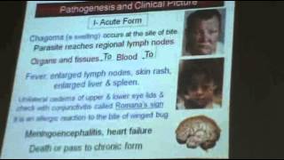 DrAzza  Protozoa 5  Trypanosoma  Part 4 [upl. by Htedirem]